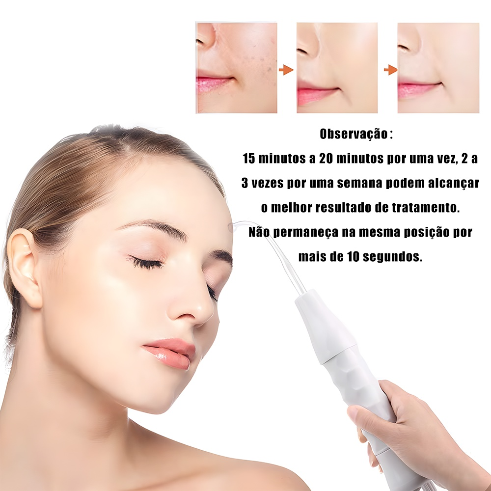 Aparelho de Alta Frequência Portátil Bivolt – Limpeza Facial, Antiacne e Antirrugas Profissional – Modernara