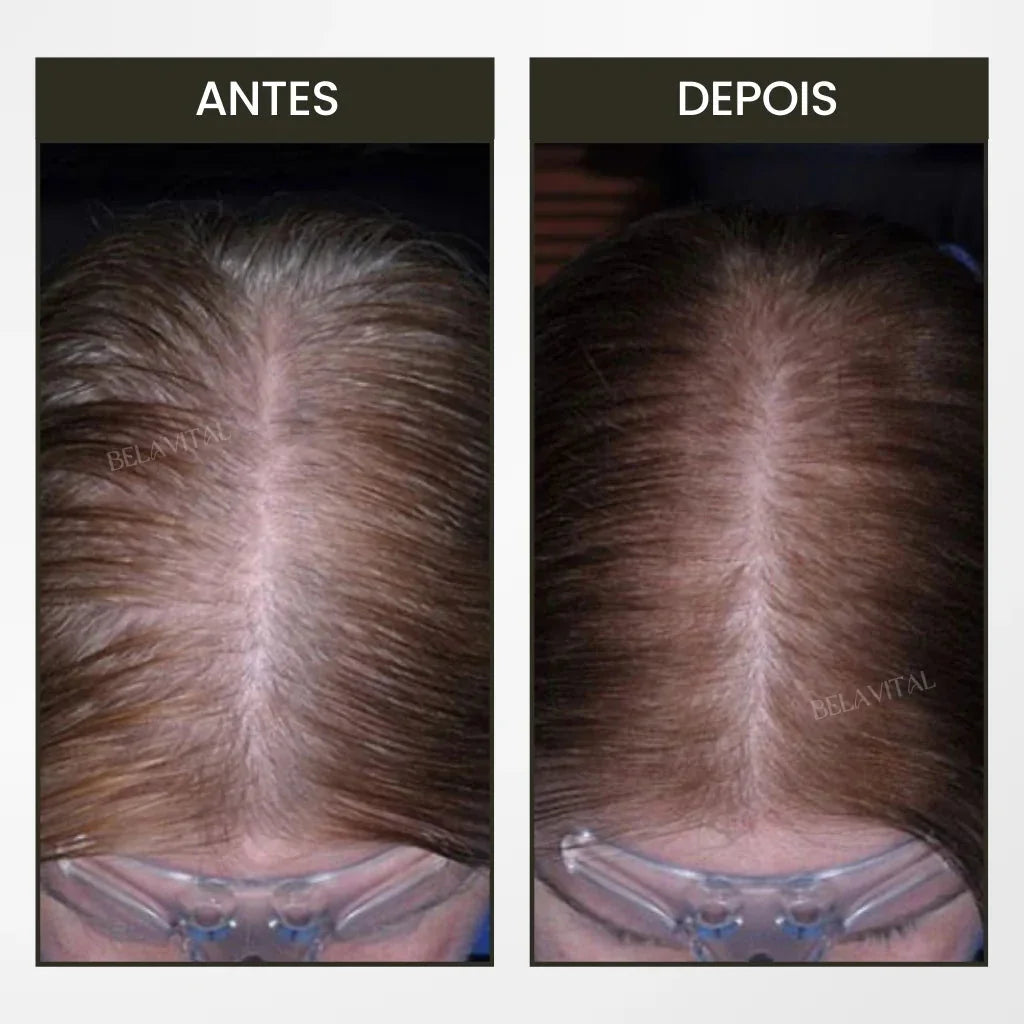 Escova Massagem Capilar com Aplicador de couro cabeludo Elétrico Luz vermelha