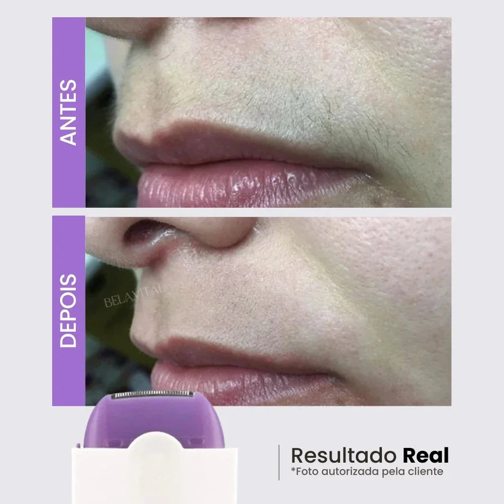 Depilador Elétrico Facial e Corporal Recarregável Sem Dor – Ideal para Homens e Mulheres | Modernara